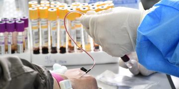 Эрт илрүүлгийн үзлэг, оношилгооны санхүүжилтийг түр хугацаагаар зогсоожээ