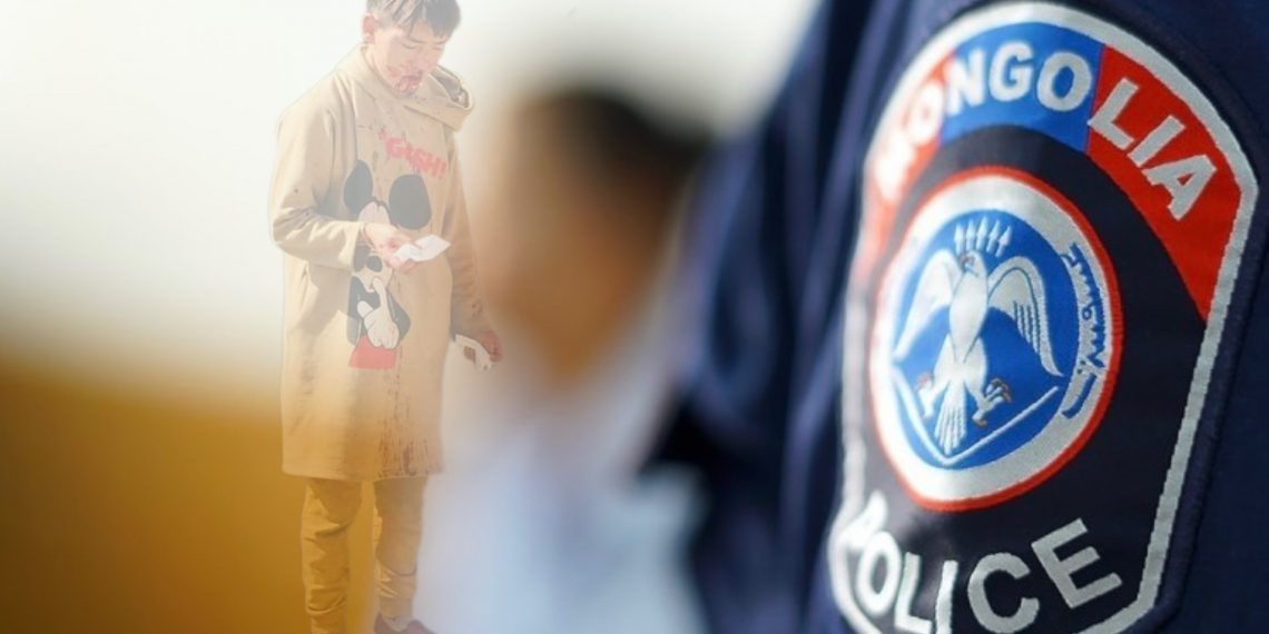 ЦЕГ: Иргэн О.Осоржамаагийн нас барсан шалтгааныг тогтоох шинжилгээний хариу гараагүй байна